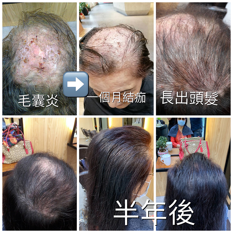 見證
