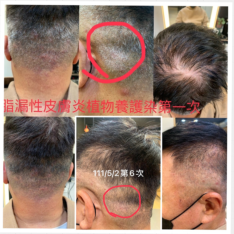 見證